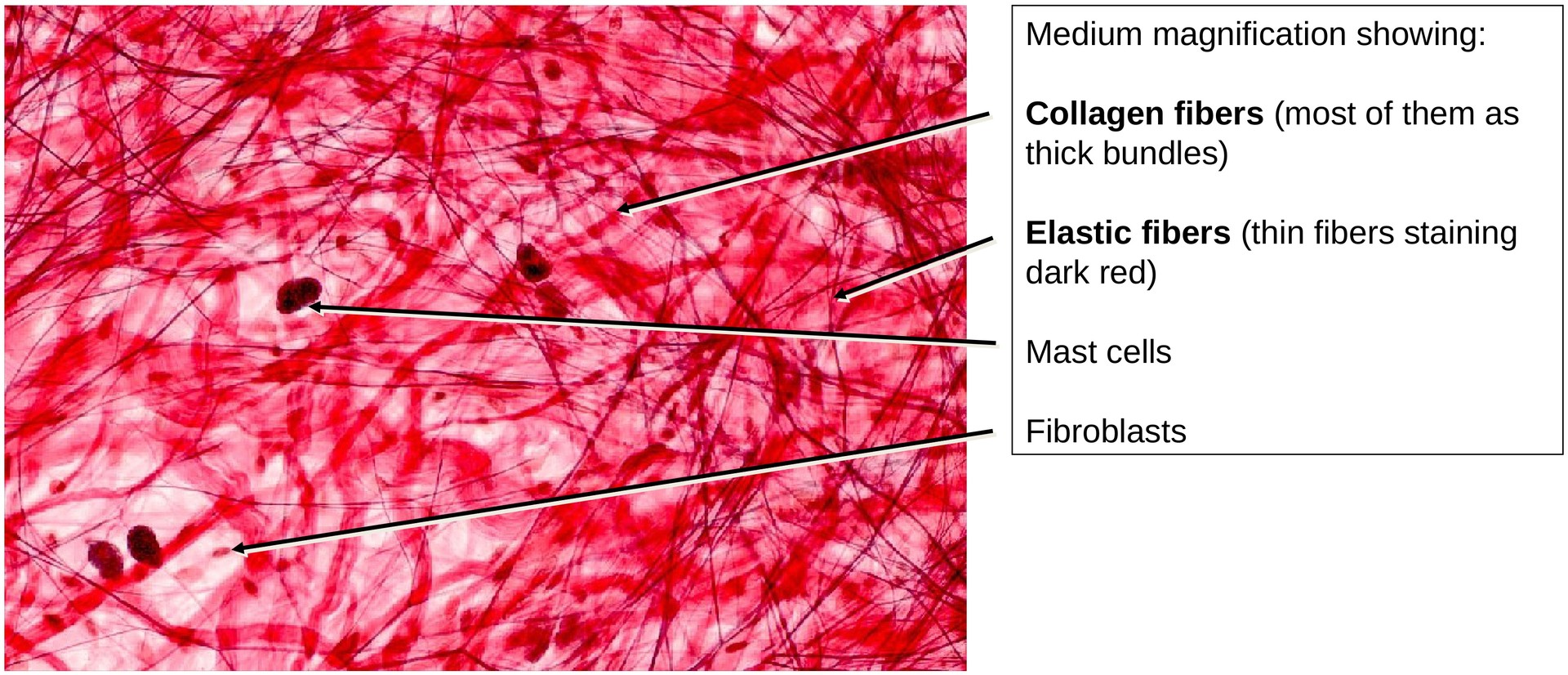 Loose connective tissue (Mesentery)