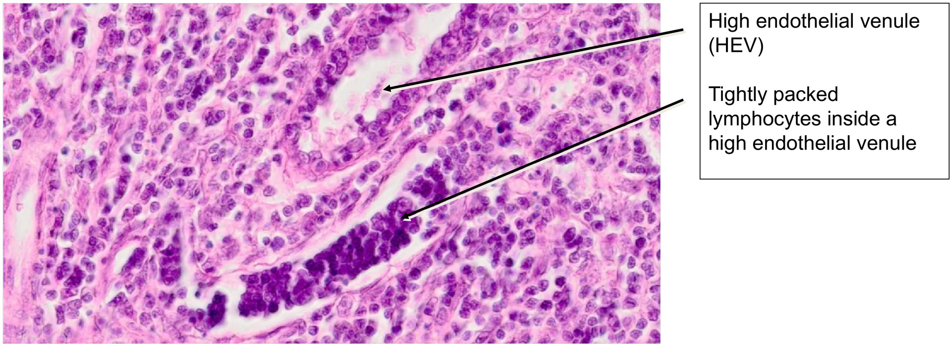 Ileum, Peyer’s patches