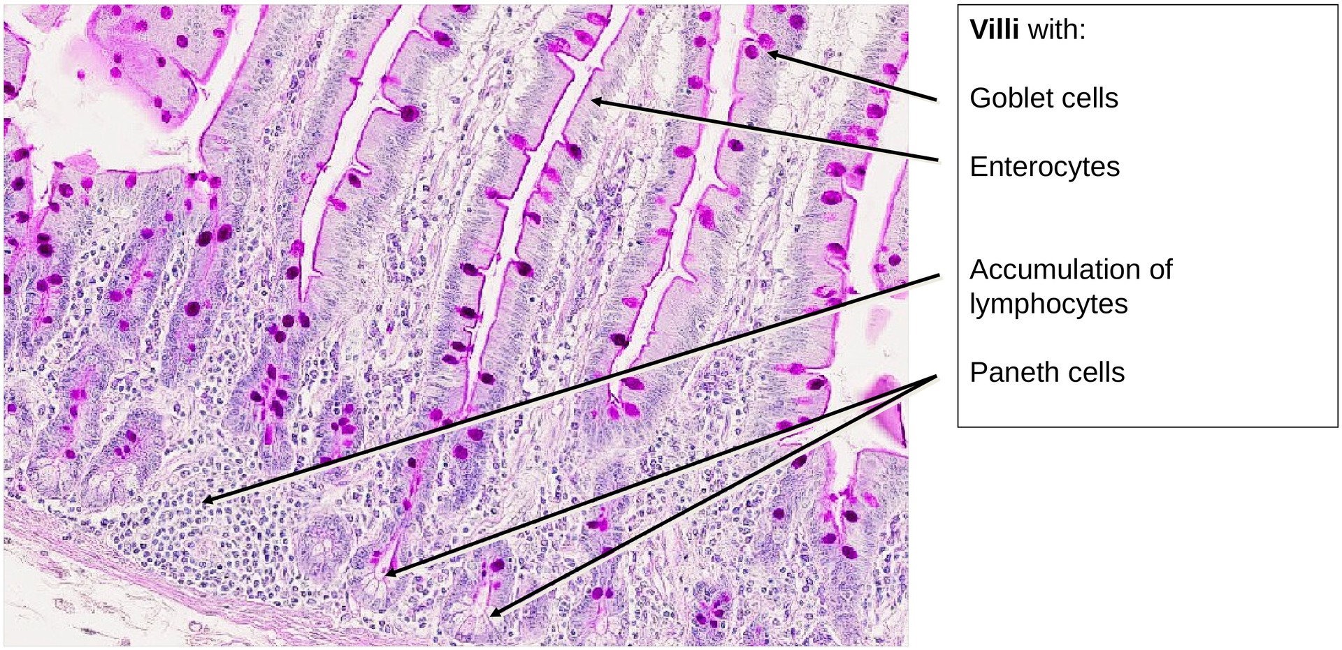 Jejunum, human 1