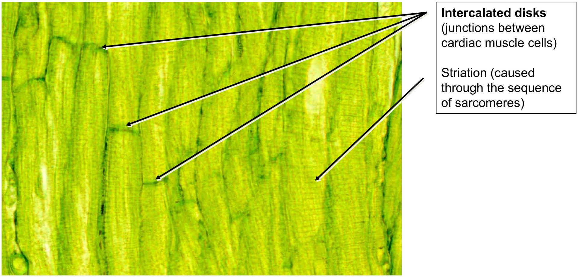 Intercalated discs (Heart muscle)