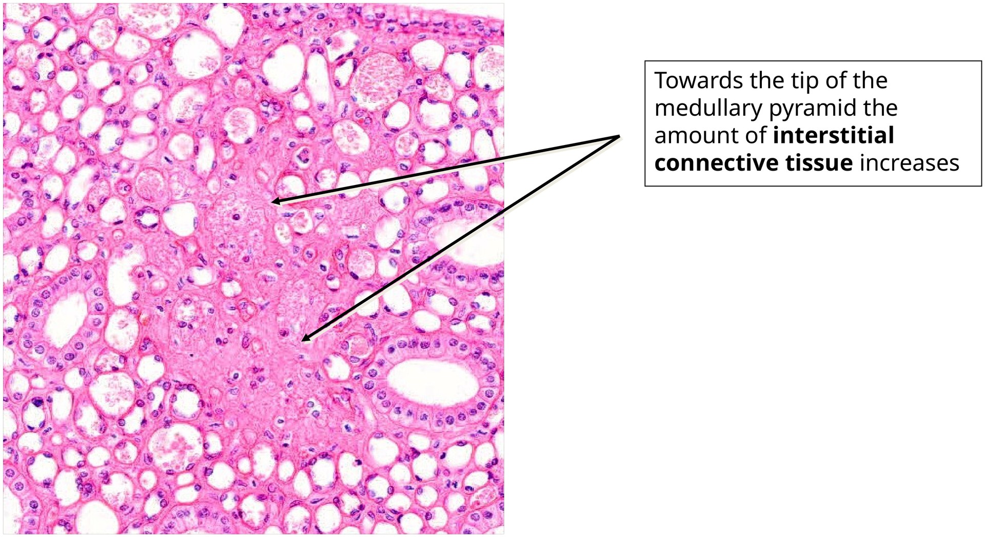 Connective tissue of the medullary pyramid (kidney)