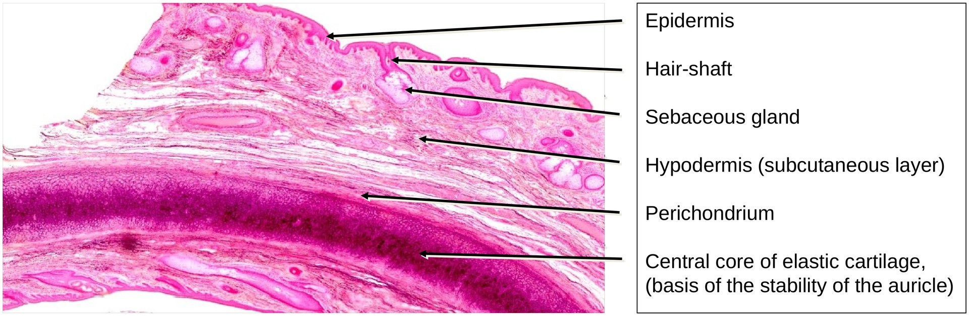 Elastic cartilage (Ear)