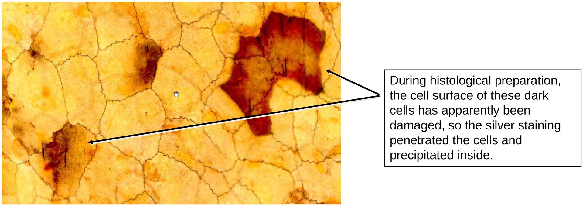 Cell boundaries (mesentery)