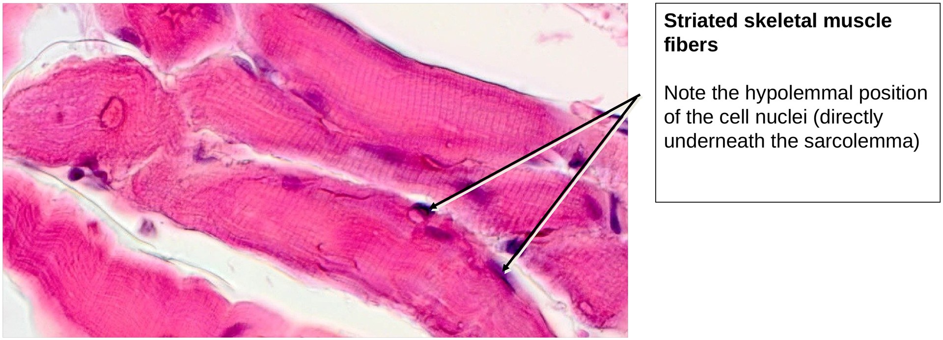 Ossification, endochondral