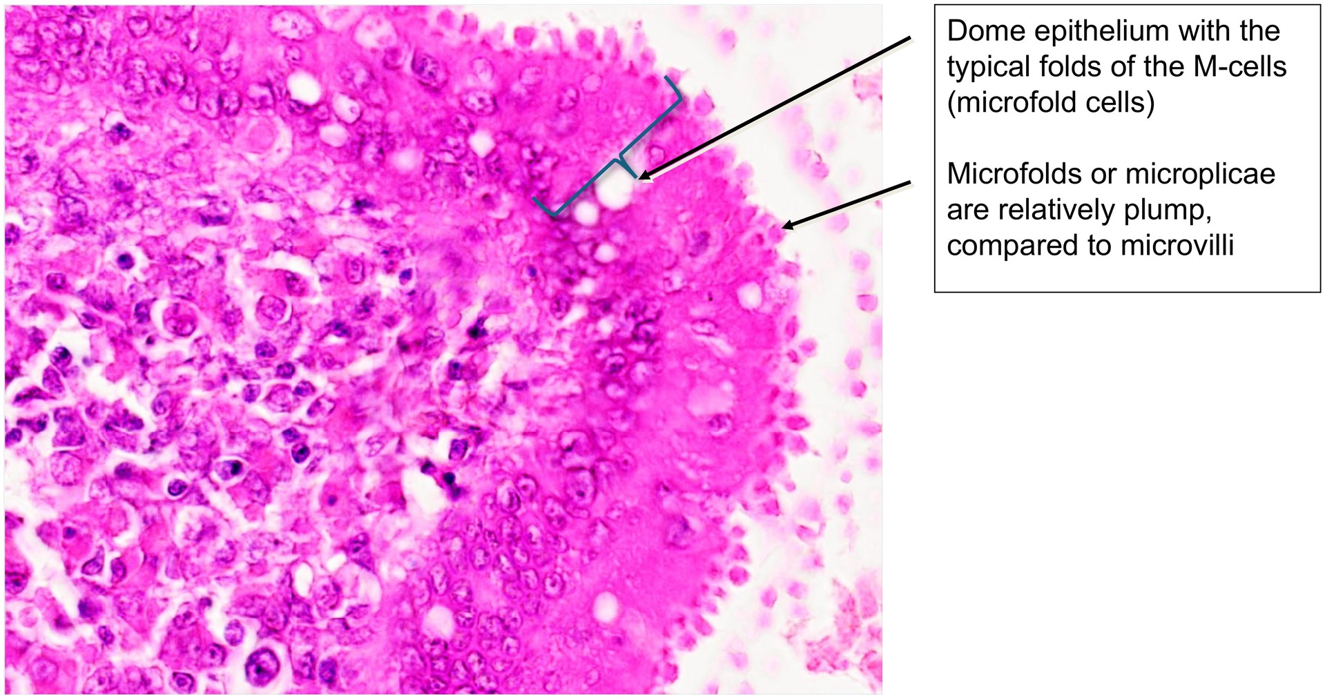 Ileum, Peyer’s patches