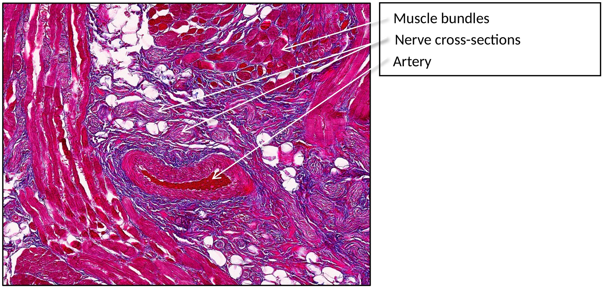 Tongue filiform papillae