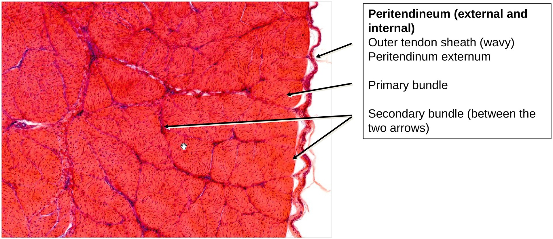 Collagen fibers (Tendon, transverse section)