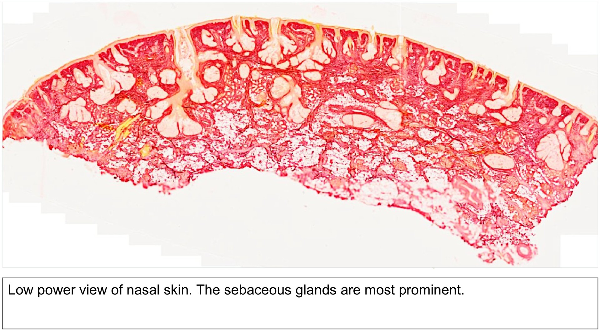 Nasal skin