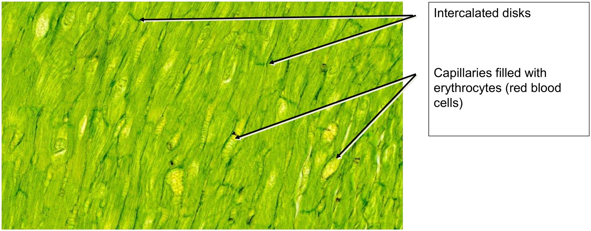Intercalated discs (Heart muscle)