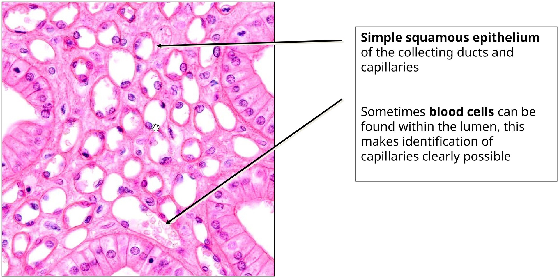 Simple squamous epithelium (kidney)