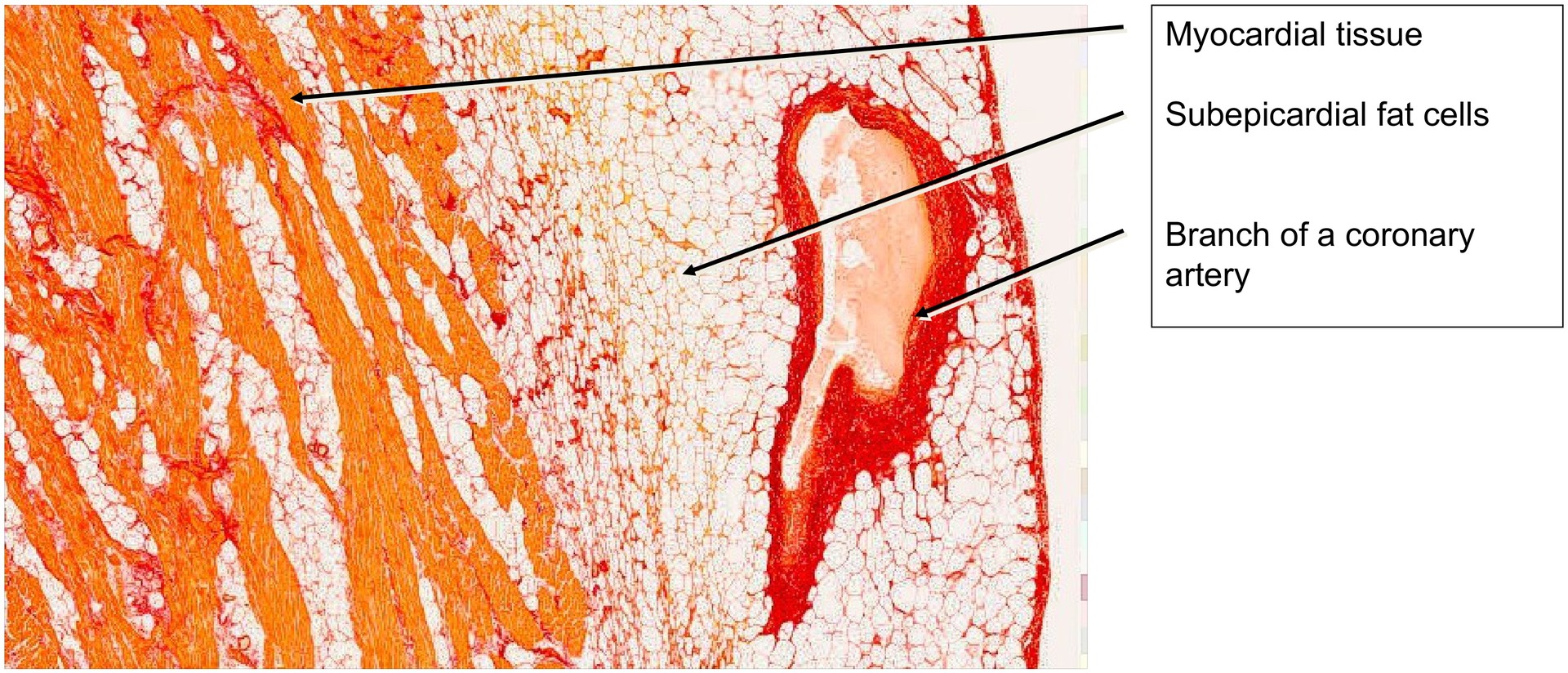Cardiac muscle (Trabeculae)