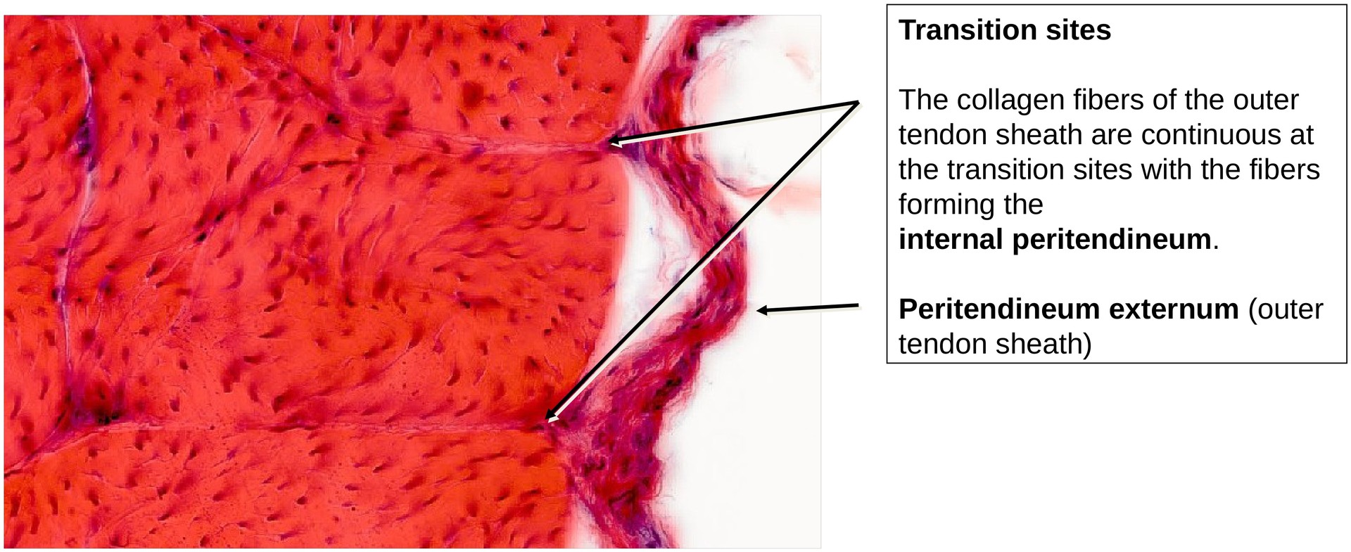 Collagen fibers (Tendon, transverse section)
