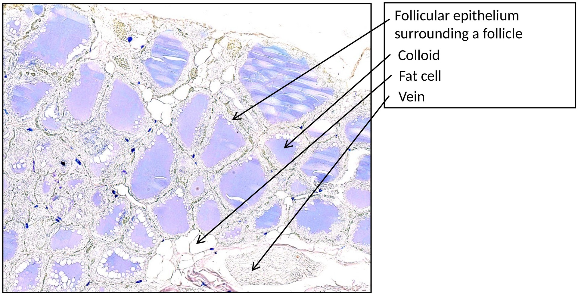 Thyroid gland C cells