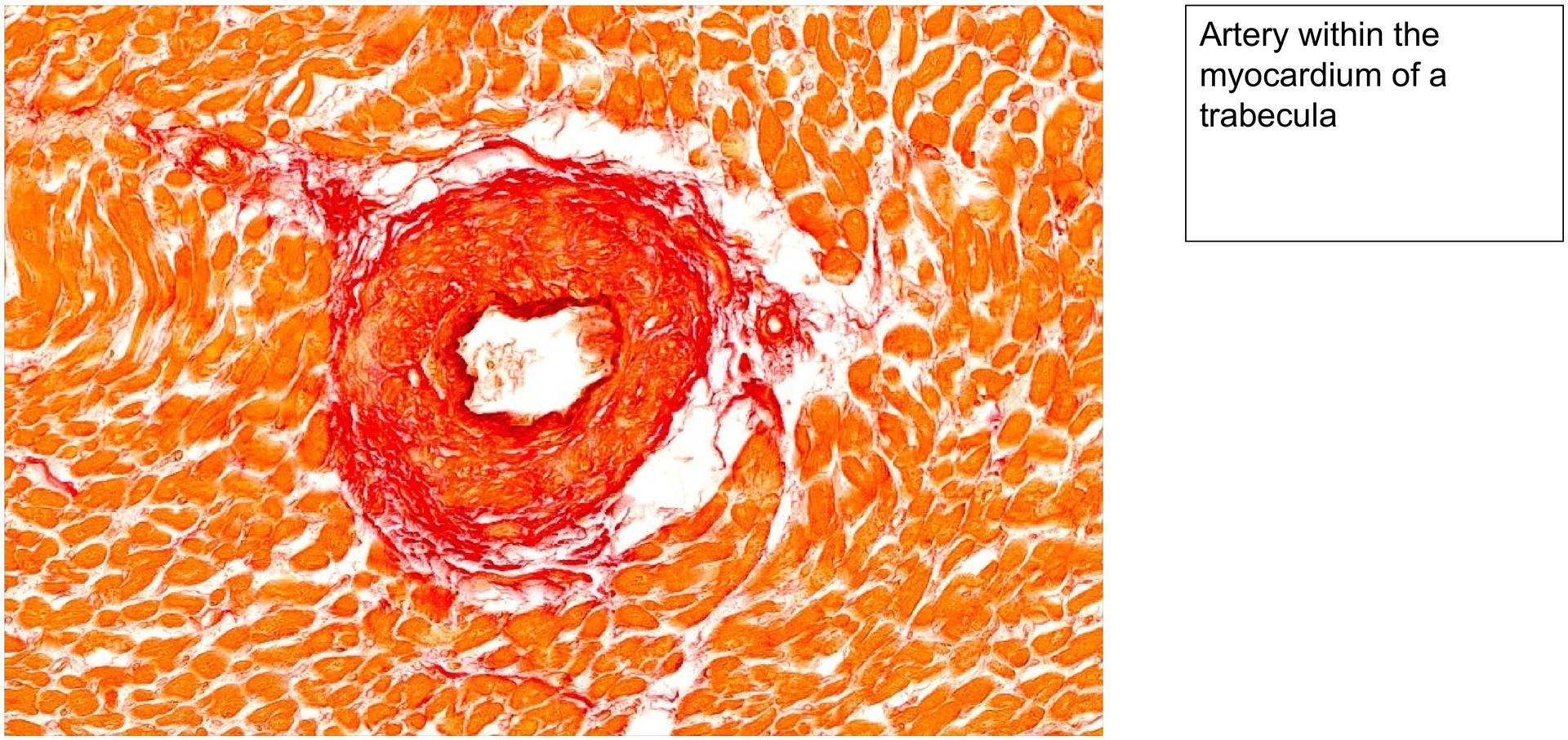 Cardiac muscle (Trabeculae)