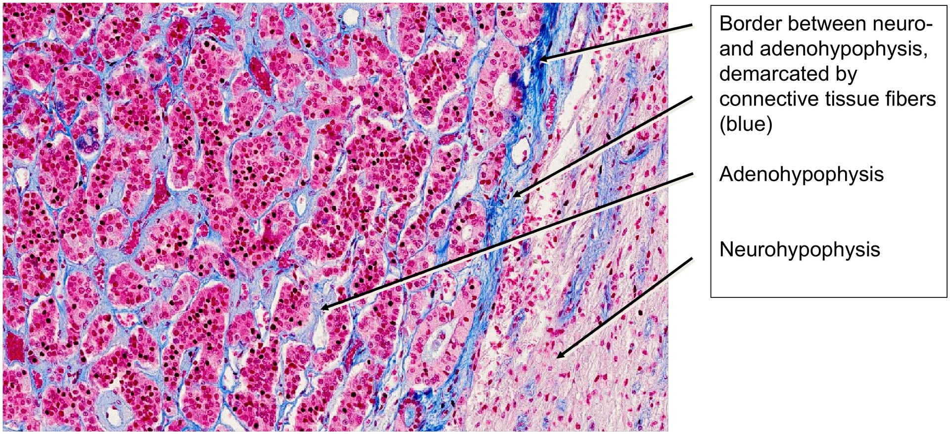 Pituitary gland (Hypophysis)