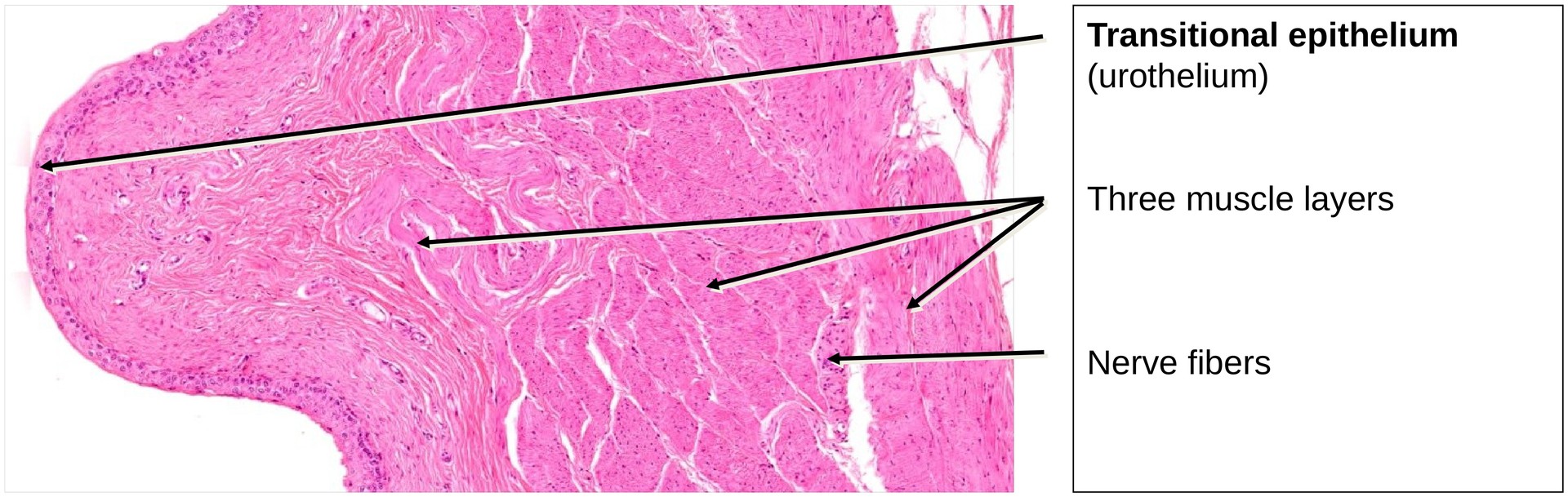 Transitional epithelium (urinary bladder)