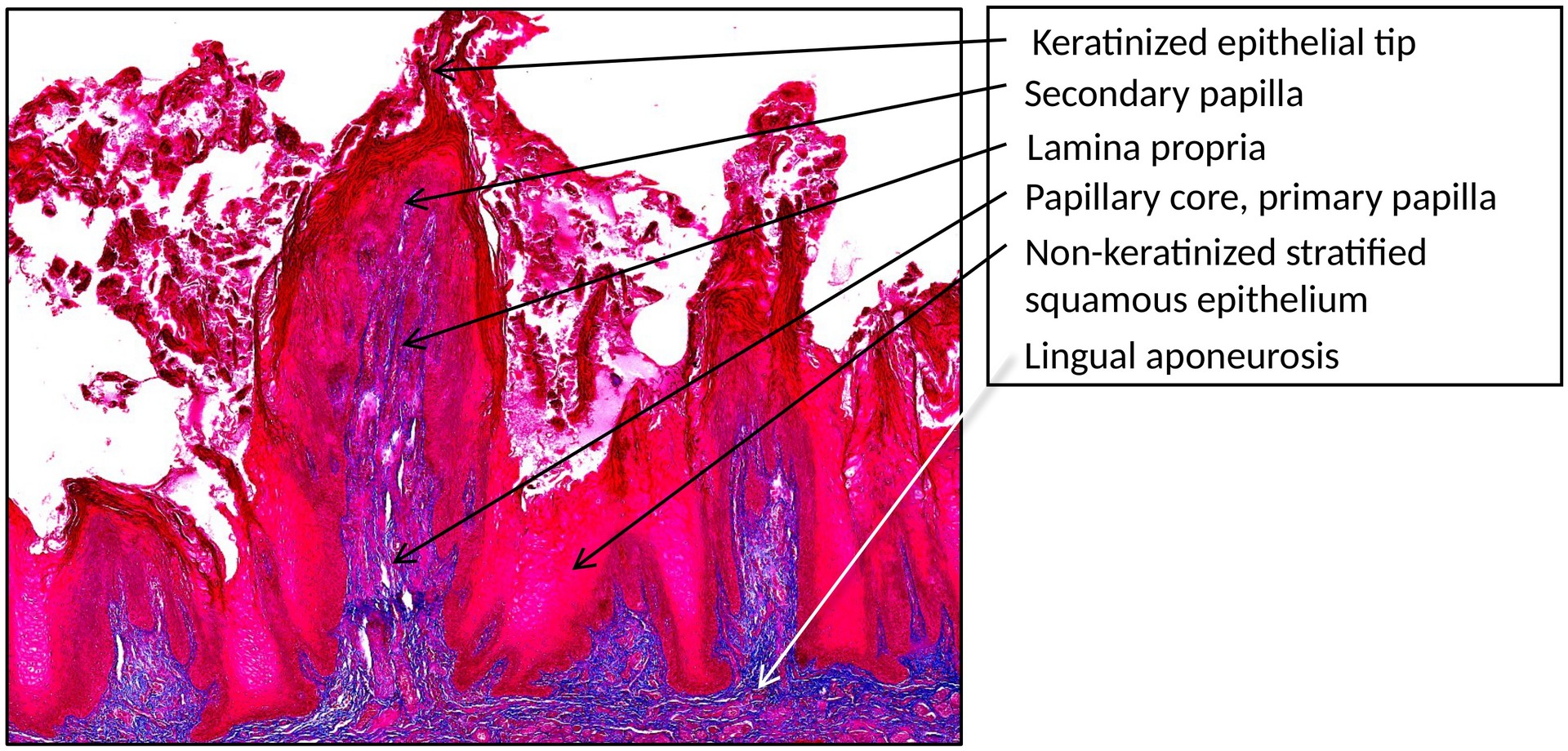 Tongue filiform papillae