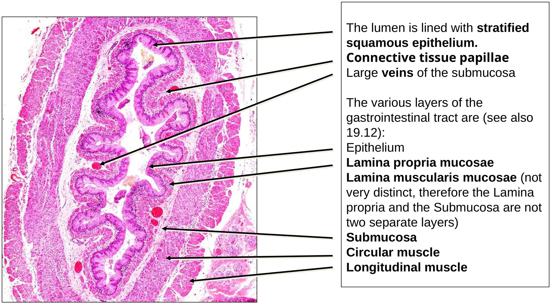 Stratified squamous epithelium (Oesophagus)