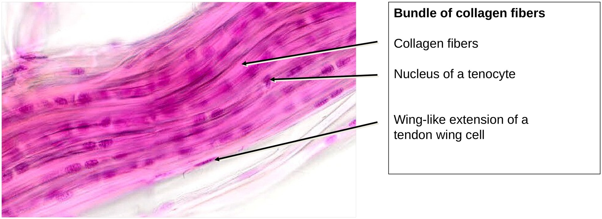 Collagen fibers (Tendon)