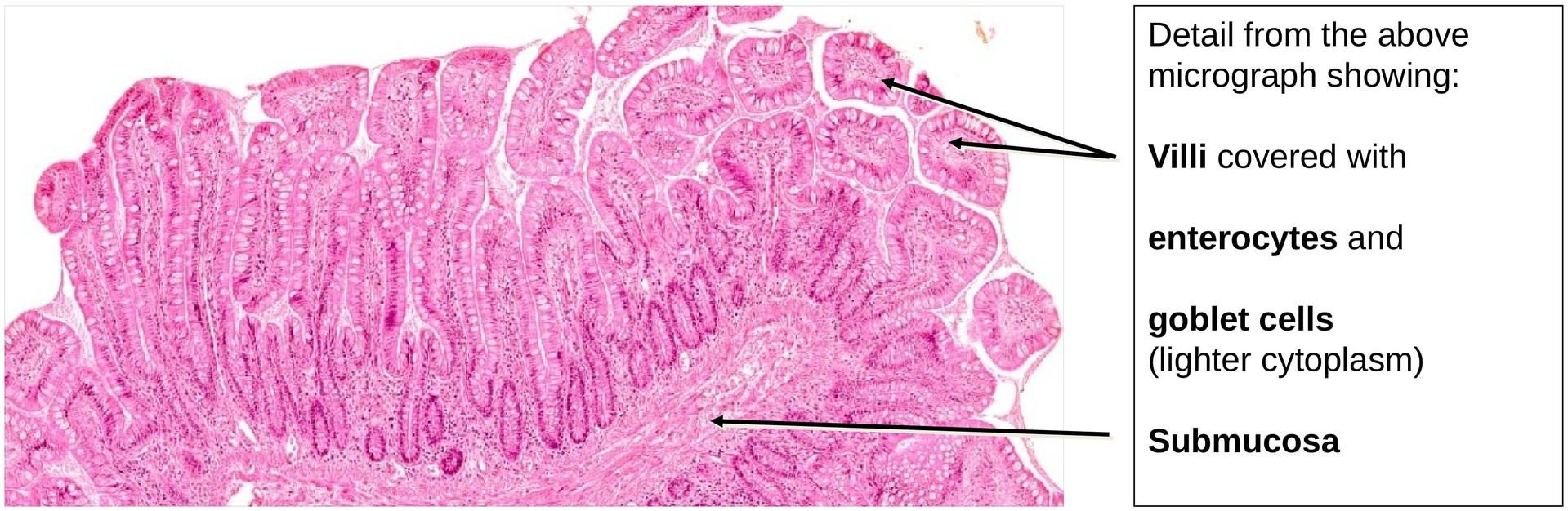 Ileum, Human 1
