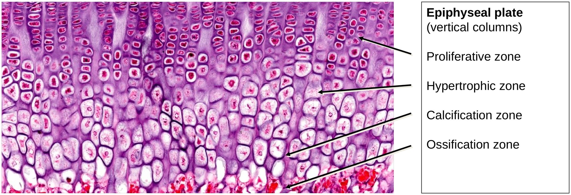 Ossification, endochondral