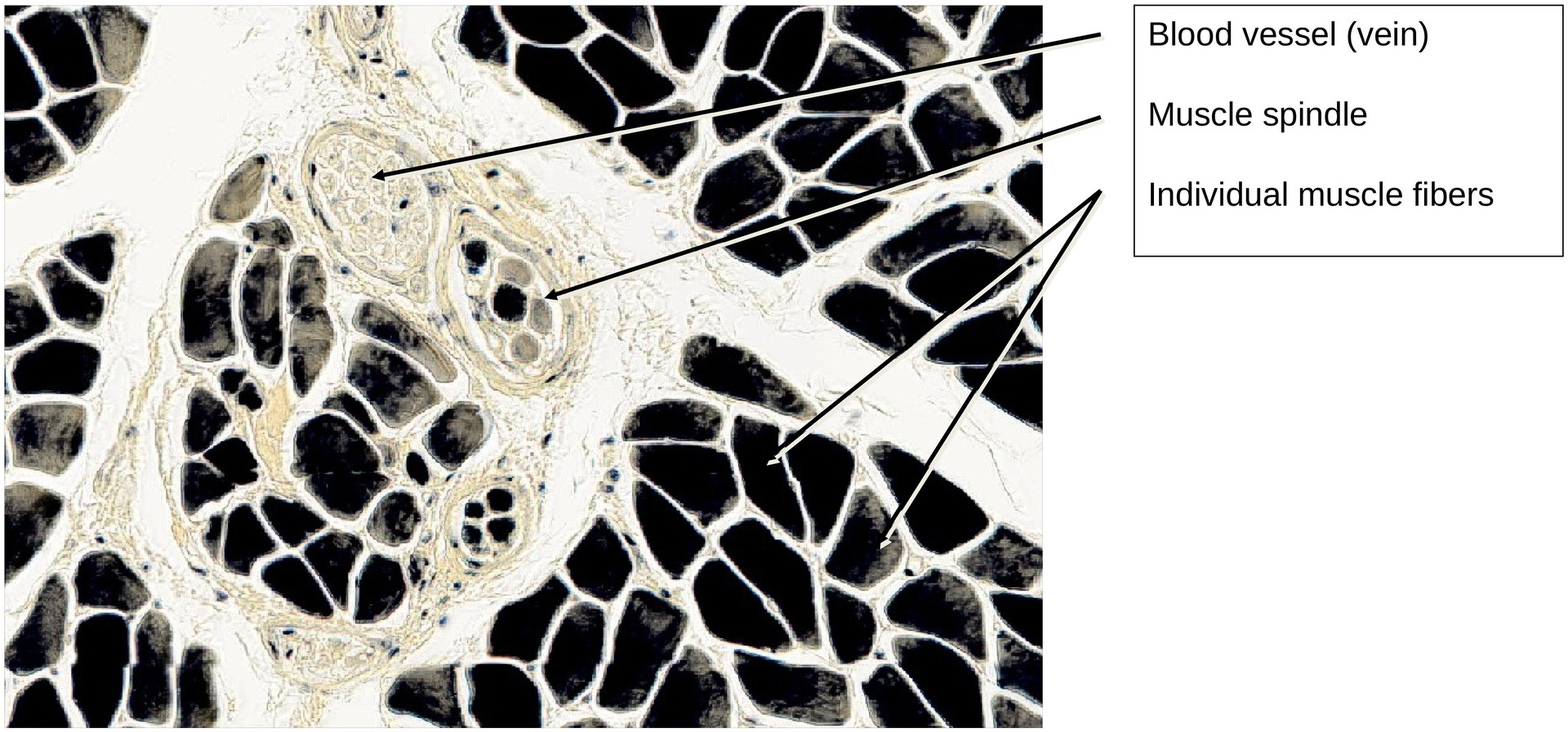 Skeletal muscle (transverse)