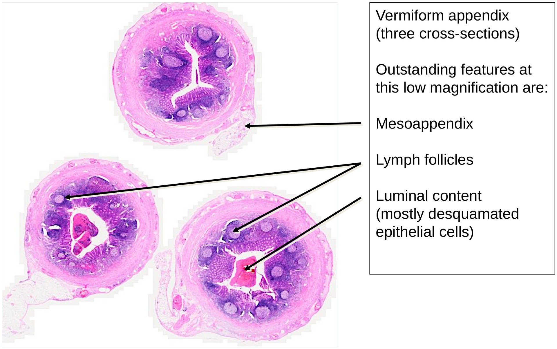 Vermiform appendix