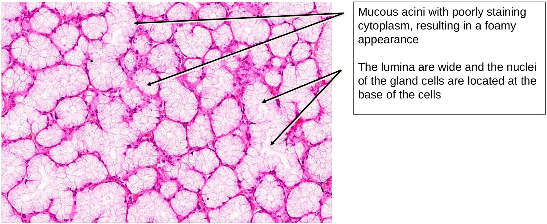 Sublingual gland 1