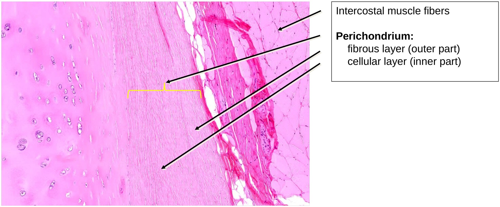 Hyaline cartilage (Rib)