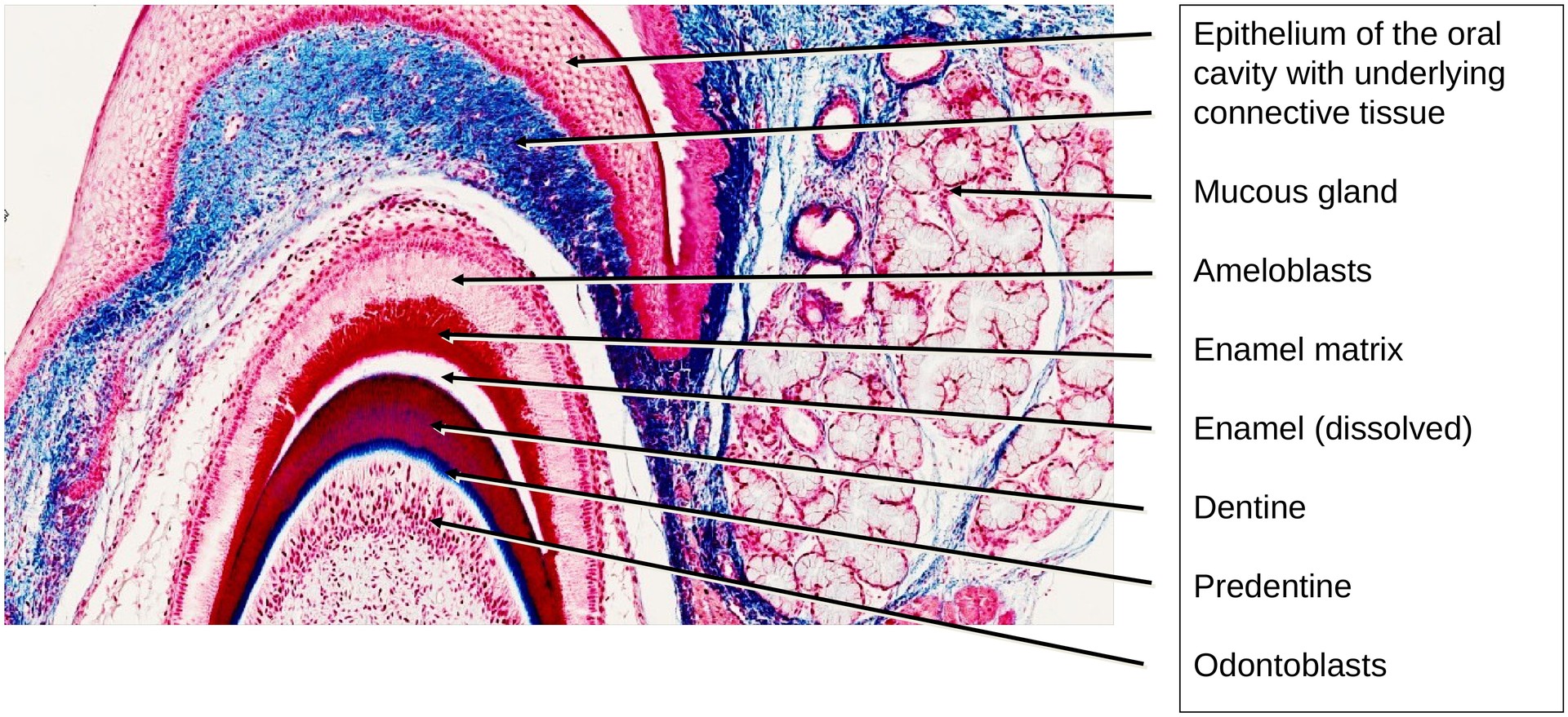 Tooth development II