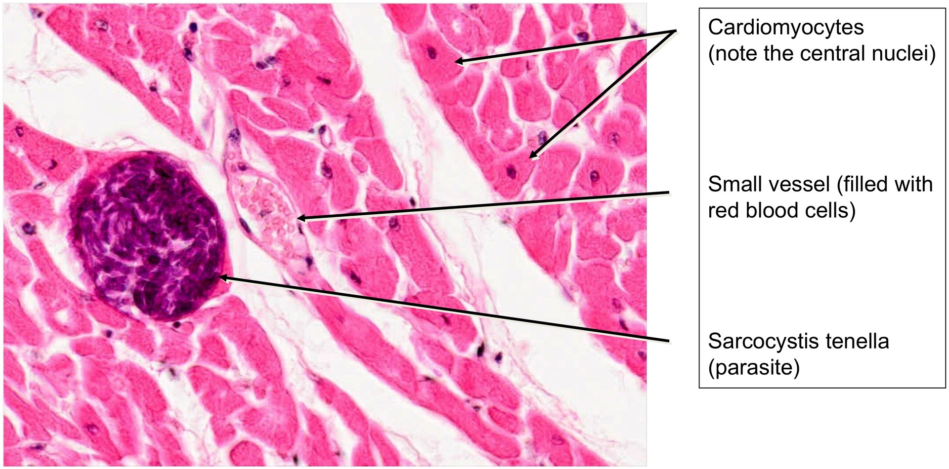 Cardiac conduction system
