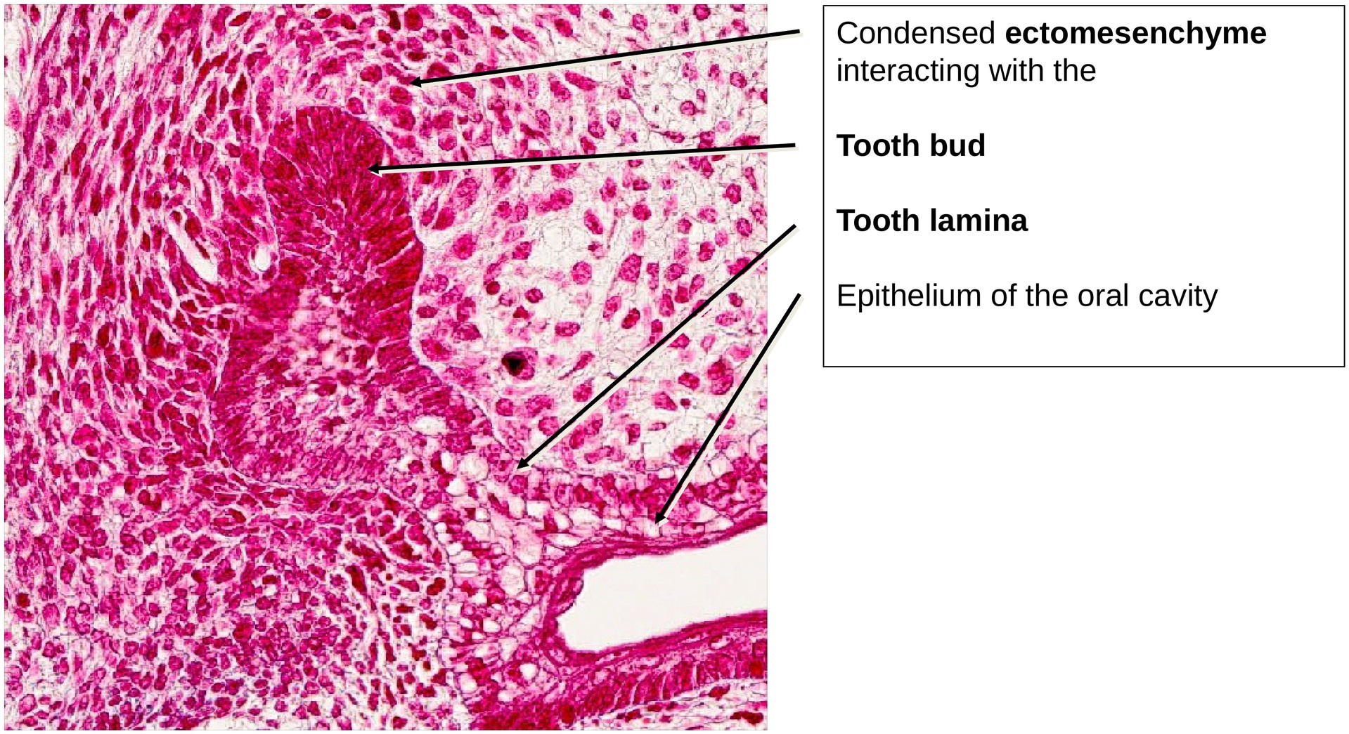 Tooth development I