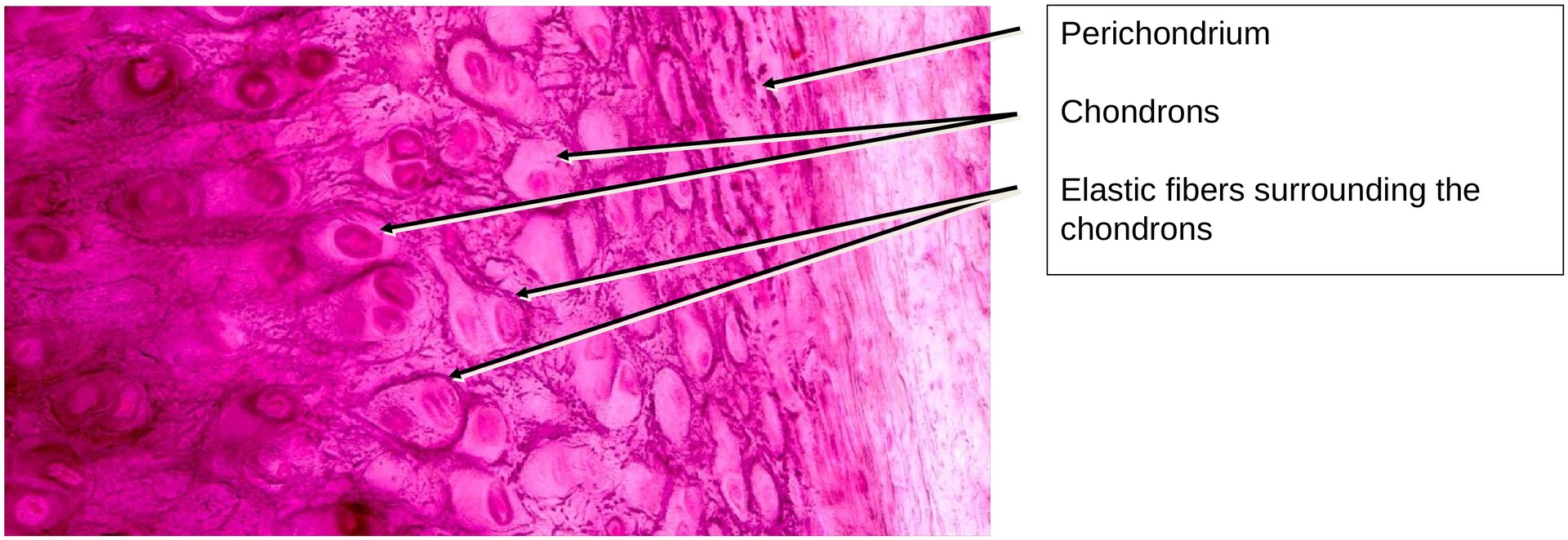 Elastic cartilage (Ear)