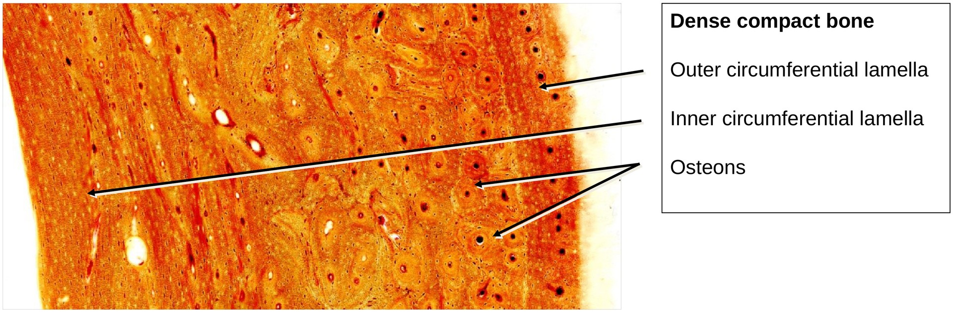 Lamellar bone (Dog, Tibia)