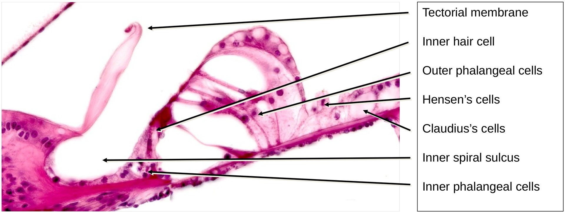 Inner ear, Organ of Corti