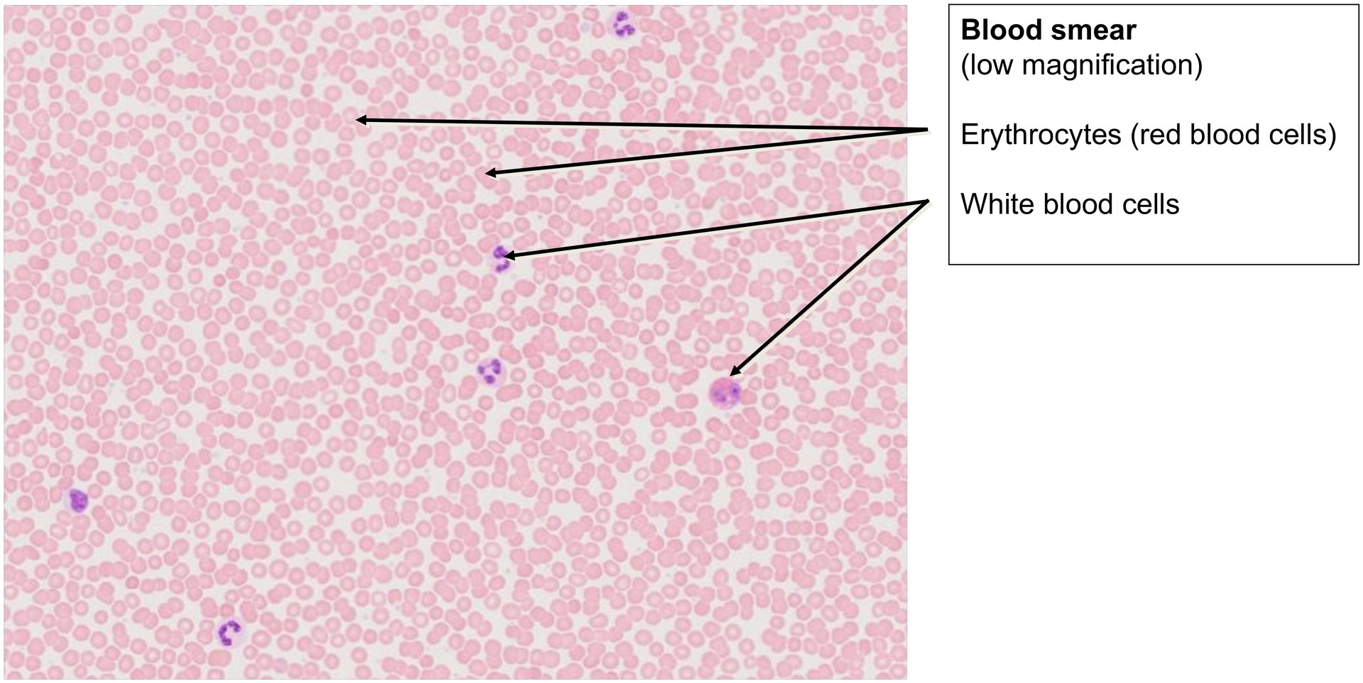 Blood smear