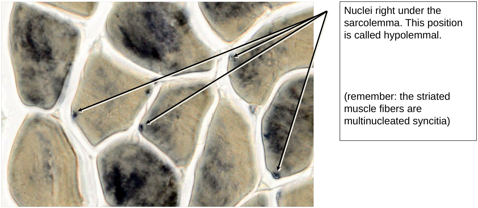 Skeletal muscle (transverse)