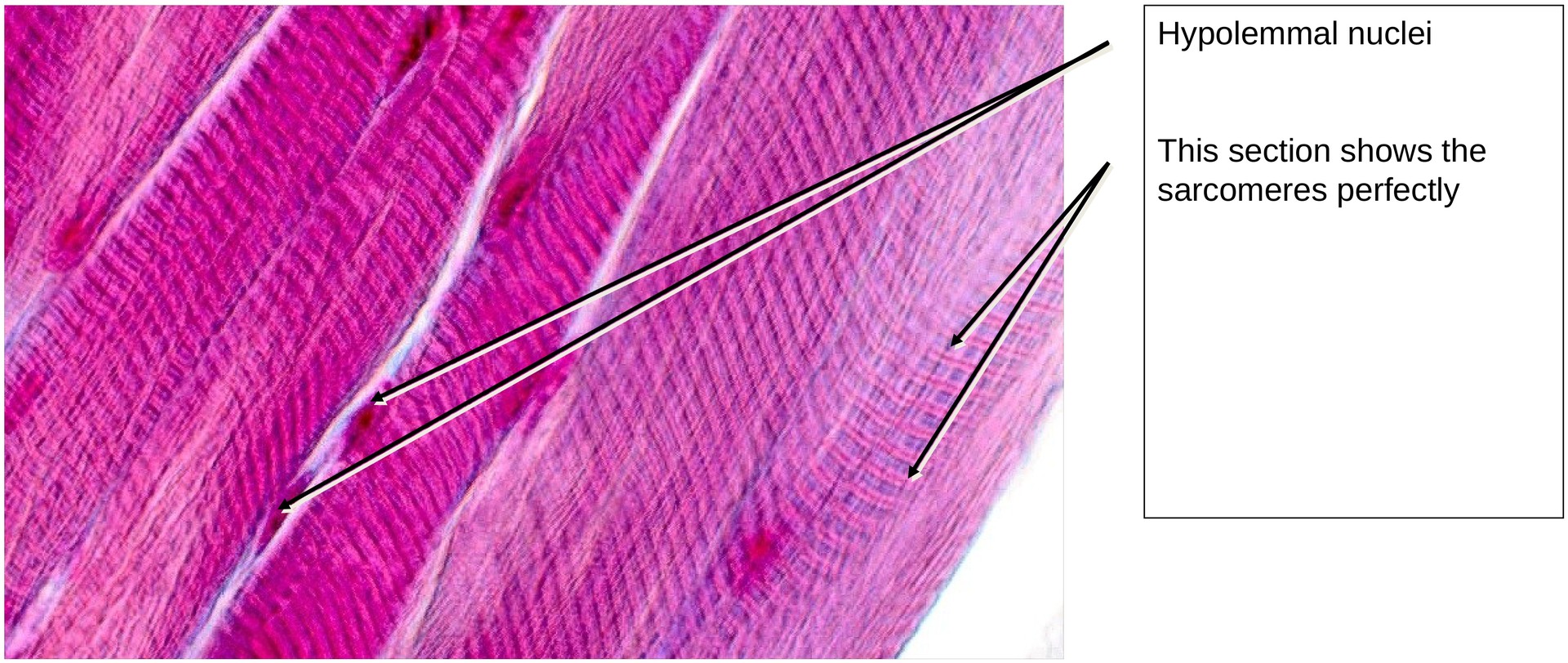 Skeletal muscle (longitudinal)