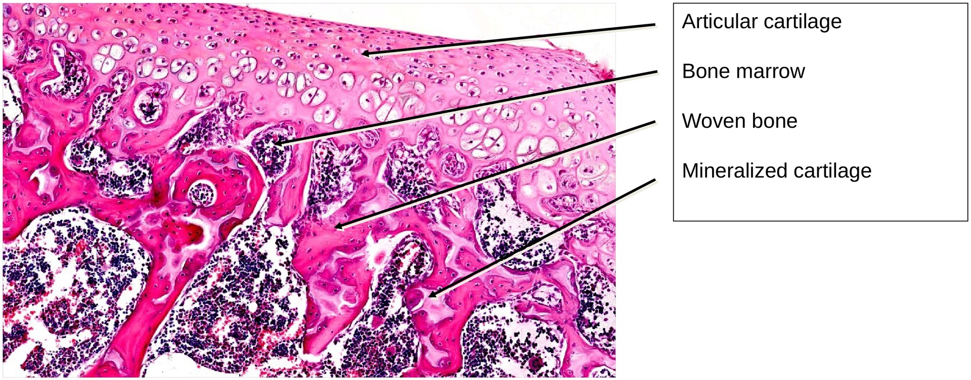 Ossification, endochondral