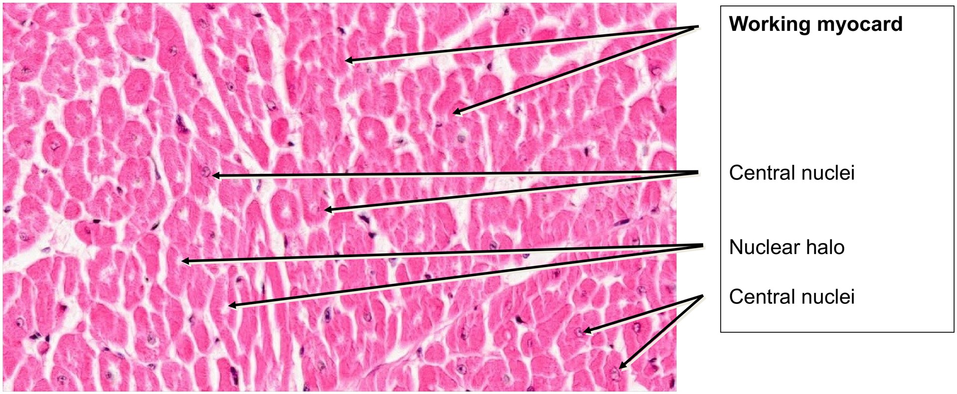 Cardiac conduction system