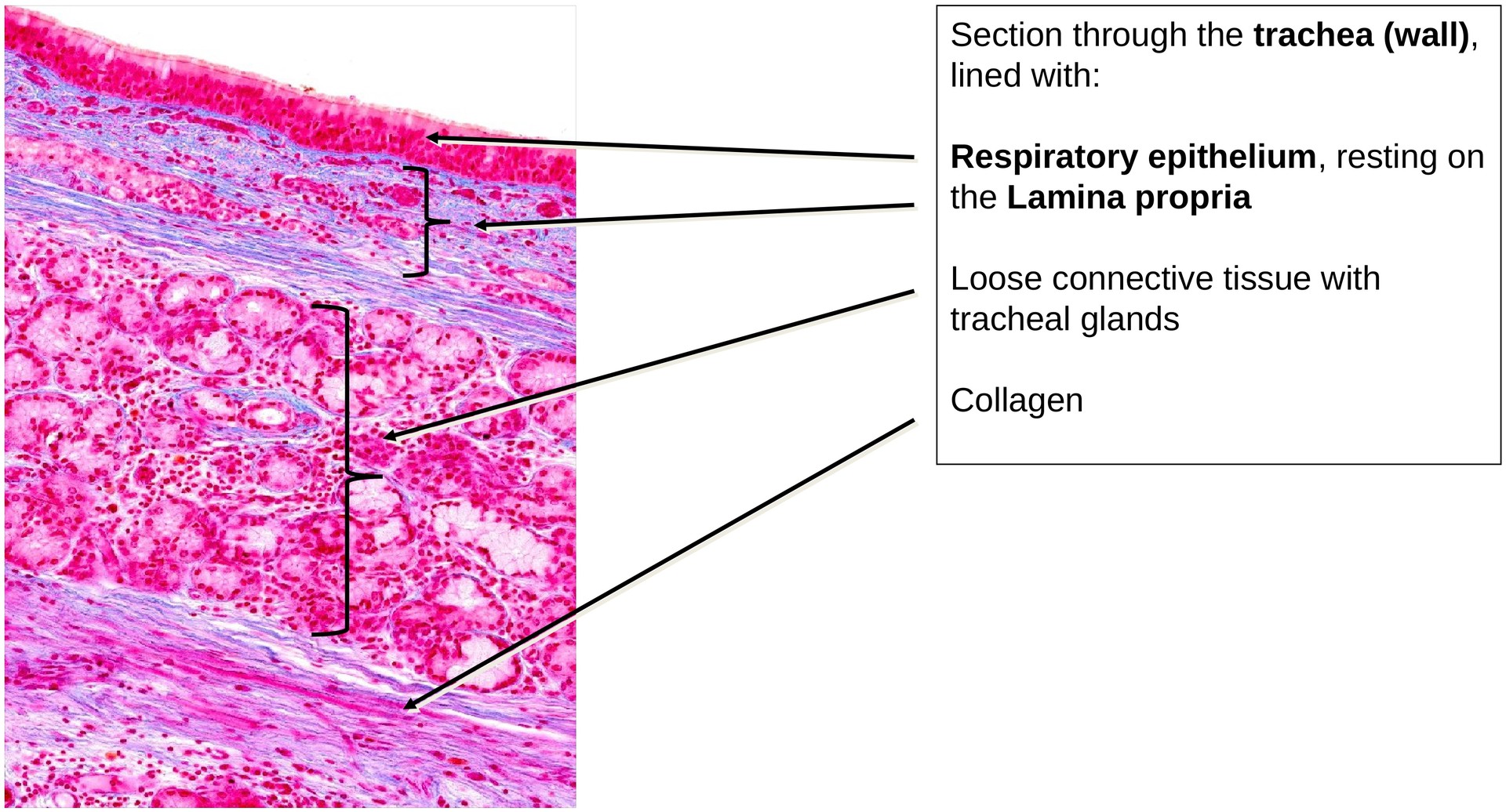 Respiratory epithelium (trachea)