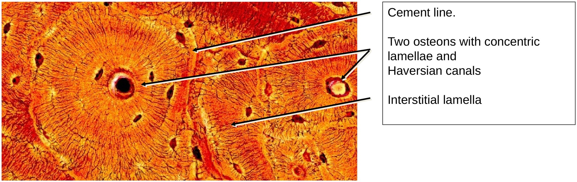 Lamellar bone (Dog, Tibia)