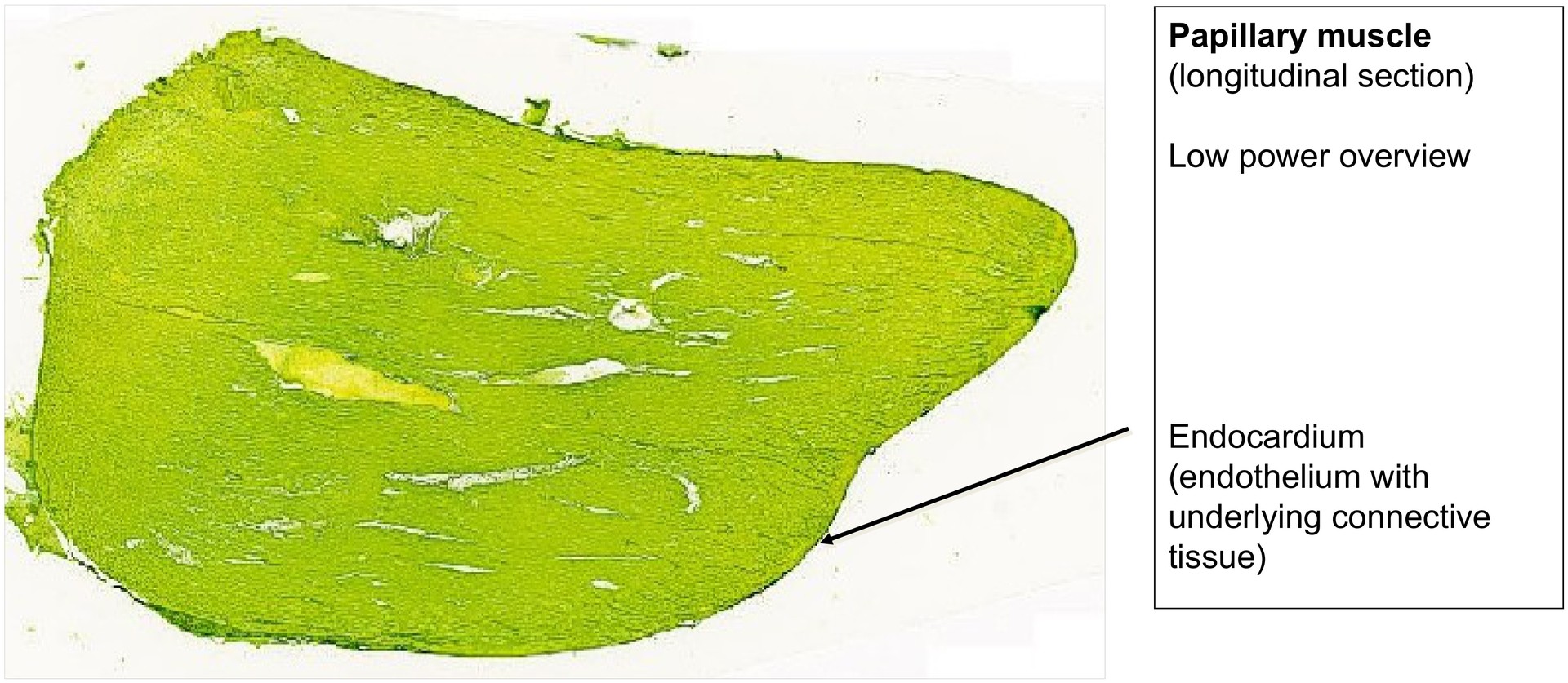 Intercalated discs (Heart muscle)