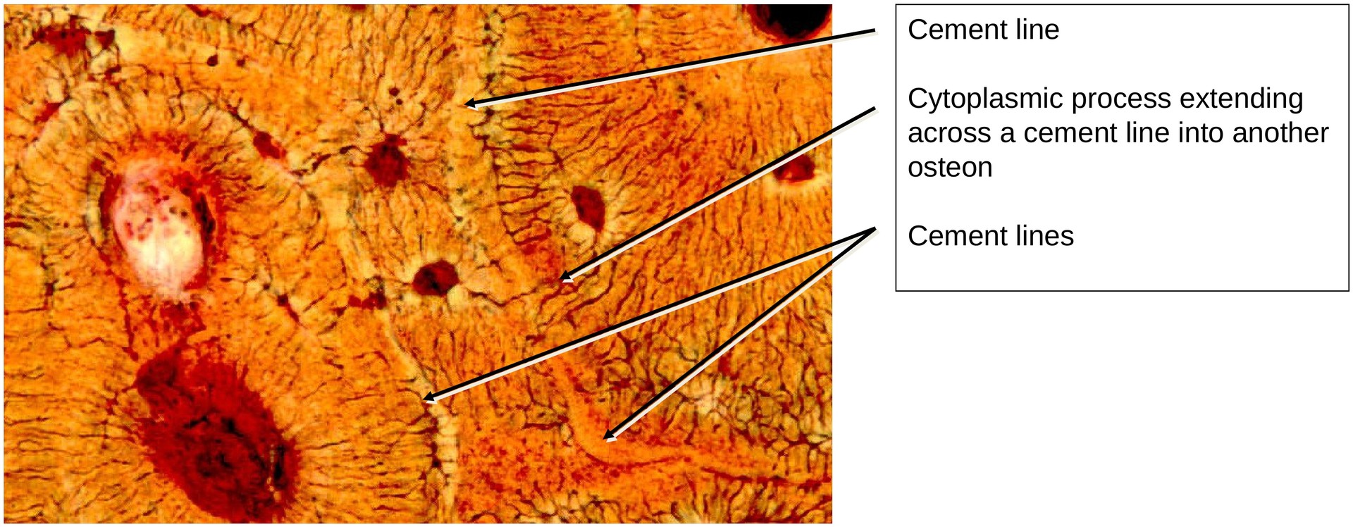 Lamellar bone (Dog, Tibia)