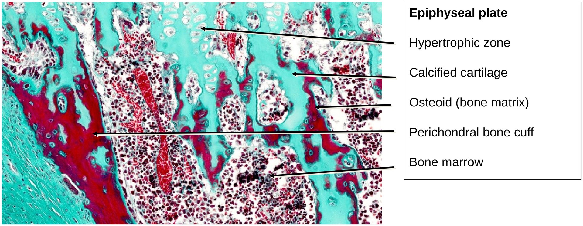 Ossification, perichondral (Finger)