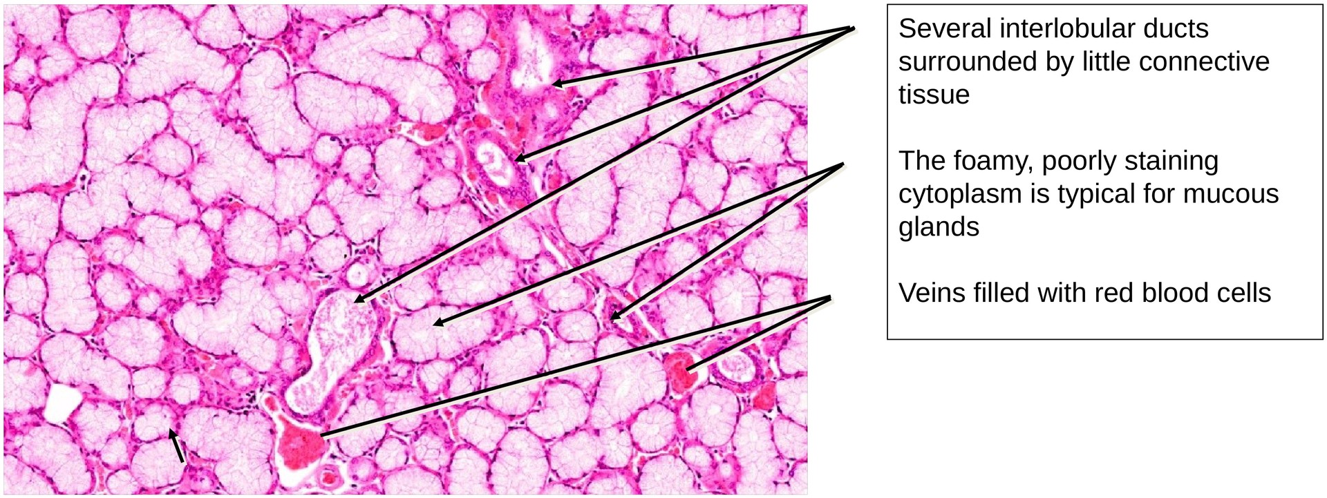 Sublingual gland 1