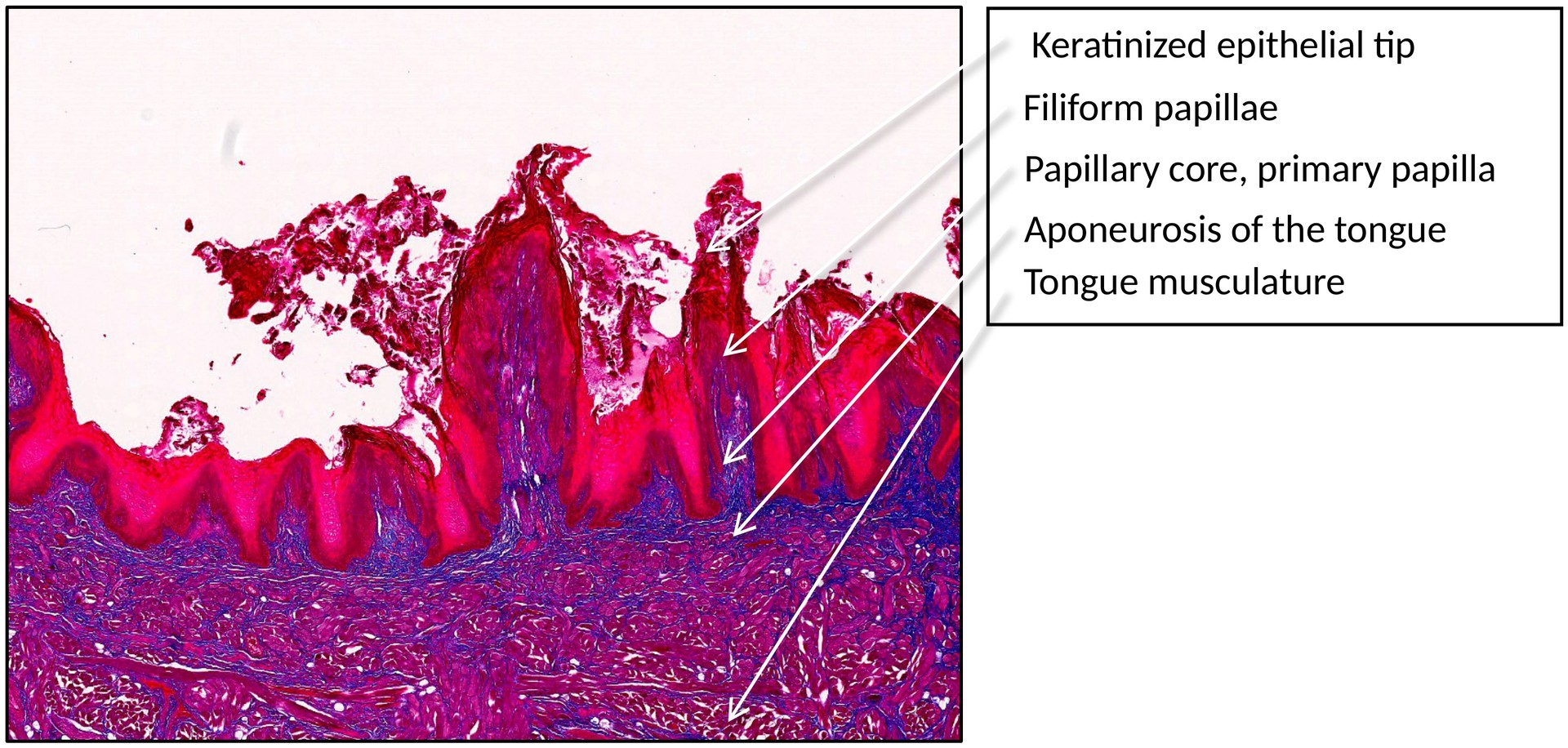 Tongue filiform papillae