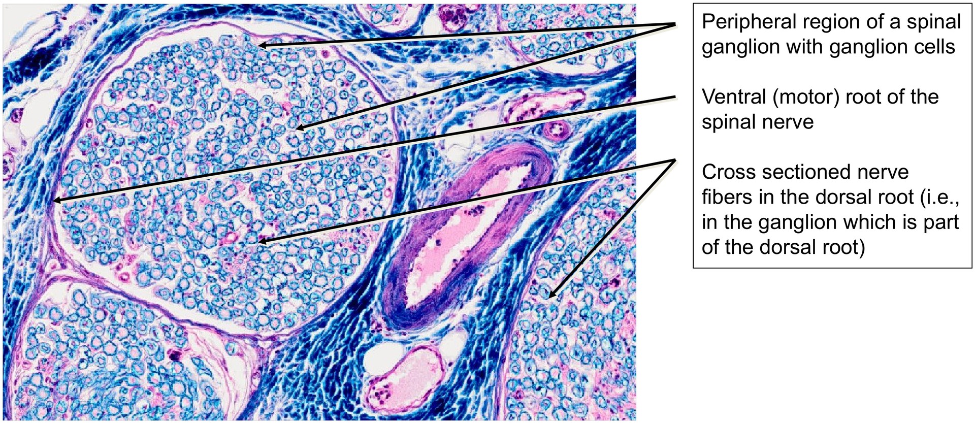 Peripheral nerve (sciatic nerve)