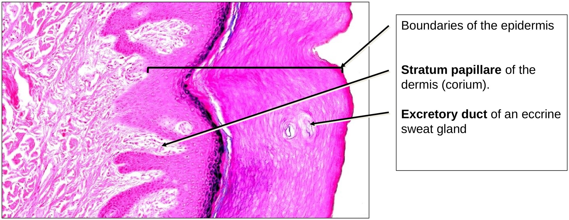 Keratinized stratified squamous epithelium (finger skin)
