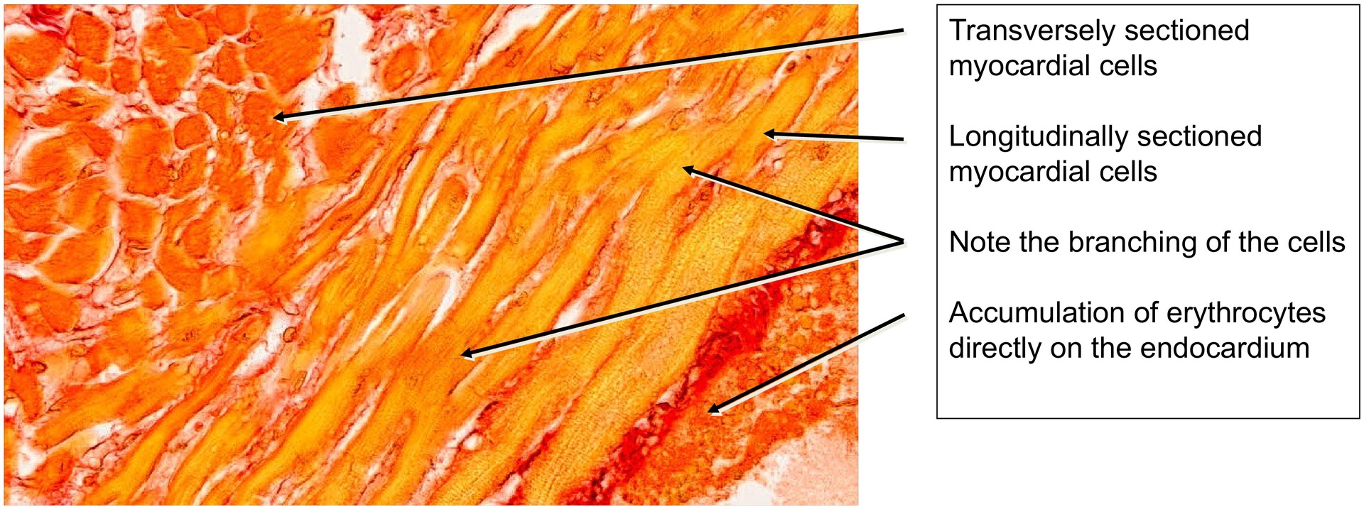 Cardiac muscle (Trabeculae)